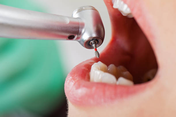 Best Tooth Infection Emergency Dentist  in Somerset, WI